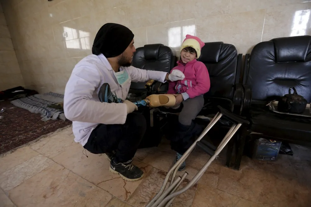 Syria's Mobile Amputee Clinic