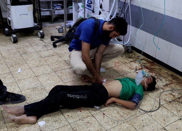 A Palestinian, who was seeking aid on Wednesday in Khan Younis, receives medical attention at Nasser hospital following an incident, in Khan Younis in the southern Gaza Strip on July 16, 2025. (Photo by Hatem Khaled/Reuters)