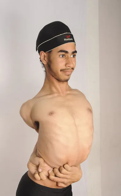 Jaspreet Singh Kalra demonstrates his flexibility skills by winding his arms around his back and wrapping them around his waist on February 28, 2015 in Ludhiana, India. A 15-year-old Indian schoolboy has left friends and family astonished by his hyper-flexibility – earning himself the nickname “Rubber Boy”. (Photo by Ajay Verma/Barcroft India)