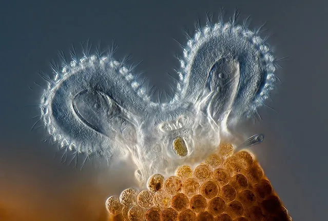 First prize winner: Rotifer Floscularia ringens feeding. Its rapidly beating cilia (hair-like structures) bring water that contains food to the rotifer. The “wheel animacules” were first described by Leeuwenhoek (ca.1702); when their cilia beat, they look like they have two wheels spinning on top. They live in reddish-brown tubes made of spherical “bricks”. Charles Krebs, Issaquah, Washington. (Photo by Olympus BioScapes)