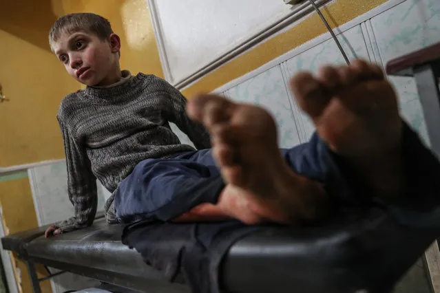 An injured child receives first aid in a hospital after a bombing in Douma, eastern Ghouta, Syria, 08 February 2018 (issued 09 February 2018). According to media reports, 75 people were killed in attacks allegedly carried out by forces loyal to the Syrian government on the rebel-held areas of eastern-Ghouta. (Photo by Mohammed Badra/EPA/EFE)