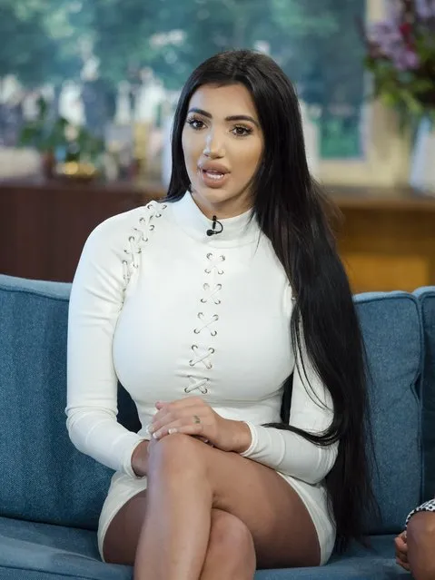 Chloe Khan at “This Morning” TV show in London, UK on August 10, 2017. Former Celebrity Big Brother star Chloe Khan is no stranger to plastic surgery, having gone under the knife for the very first time at the age of 19. But despite spending a whopping £100,000 on numerous procedures including boob jobs, butt lifts and Botox, Chloe Khan's latest operation proves that money can't always get you what you want. Instead of the smaller nose she desired, Chloe’s recent rhinoplasty has left her disfigured with the inability to smell. She joins us now to discuss her ordeal alongside doctor Sara, who'll be sharing her medical opinion on this type of surgery. (Photo by Ken McKay/ITV/Rex Features/Shutterstock)