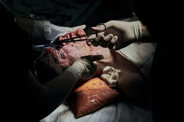 Medics operate on a Ukrainian soldier wounded in a battle with the Russian troops in a city hospital in Mykolayiv, Ukraine, Thursday, November 3, 2022. (Photo by LIBKOS/AP Photo)