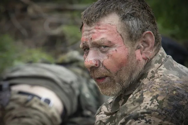 A Ukrainian soldier with a burnt face reacts as military medics give first aid to wounded soldiers on the road near Bakhmut, Donetsk region, Ukraine, Thursday, May 11, 2023. (Photo by Boghdan Kutiepov/AP Photo)