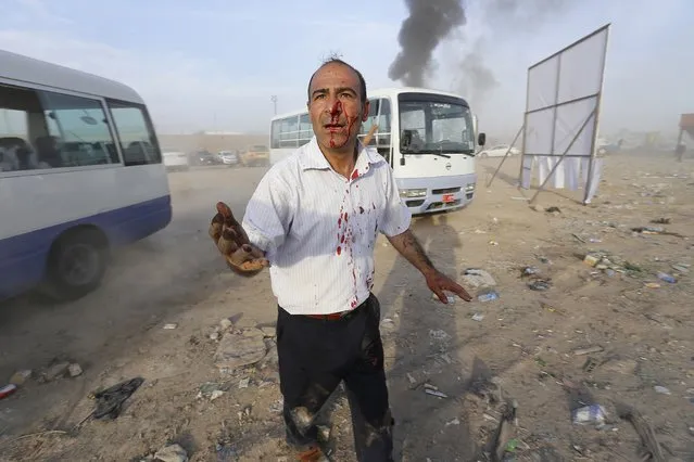 A man wounded after a car bomb attack during a Shi'ite political organisation's rally reacts at the site in Baghdad, April 25, 2014. A series of explosions killed 18 people at a Shi'ite political organisation's rally in Iraq on Friday, police and medical sources said. The militant group, Asaib Ahl Haq (League of the Righteous), introduced its candidates for elections on April 30 at the rally in eastern Baghdad. (Photo by Thaier al-Sudani/Reuters)