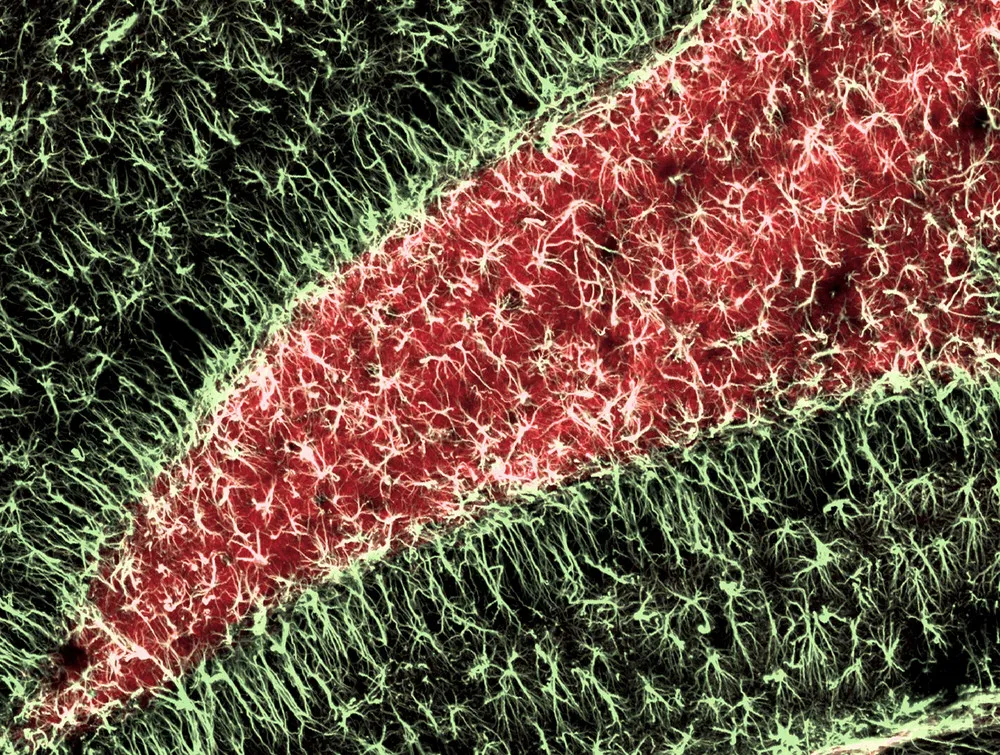 Olympus BioScapes International Digital Imaging Competition 2011