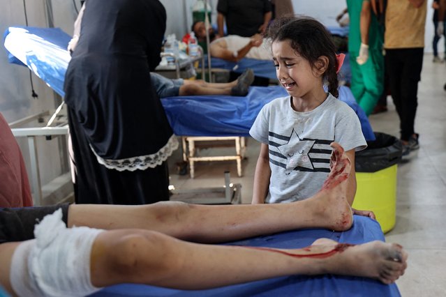 A Palestinian child reacts as she stands near a boy receiving treatment for his injuries at the Al-Awda hospital in Nuseirat in the central Gaza Strip, following Israeli strikes on July 13, 2025. Gaza's civil defense agency said Israeli air strikes on July 13 killed at least 29 Palestinians, including six children near a water distribution point. (Photo by USA Today)
