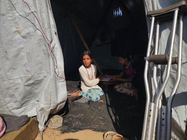 11-year-old Asil al-Najjar and her 10-year-old sister Cena continue to live in difficult conditions in a tent months after being severely injured in an Israeli attack at al-Mawasi area in Khan Yunis, Gaza on November 18, 2025. Asil lost one of his legs due to the strike, while Cena suffered a serious knee injury, and both siblings are still awaiting medical treatment. (Photo by Hani Alshaer/Anadolu via Getty Images)