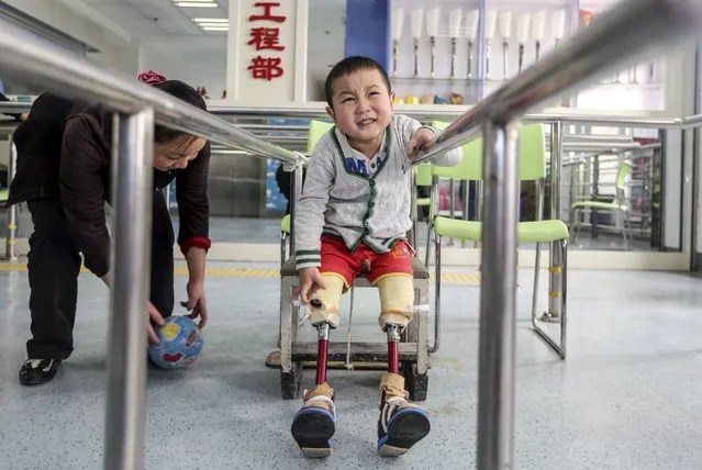 A two-year-old boy, whom local media identified by the pseudonym Xiaofeng, reacts as he practises with his prosthetic legs at a hospital in Wuhan, Hubei province, China, April 24, 2015. Xiaofeng lost his legs in a traffic accident and was installed with prosthesis earlier this month. (Photo by Reuters/Stringer)