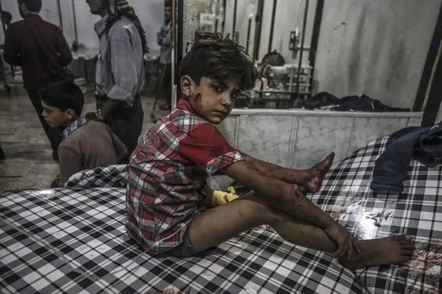 A Syrian boy receives first aid in a field hospital following airstrikes by forces loyal to the Syrian government in the rebel-held area of Douma, on the outskirts of the capital Damascus, Syria, 09 July 2016. (Photo by Mohammed Badra/EPA)