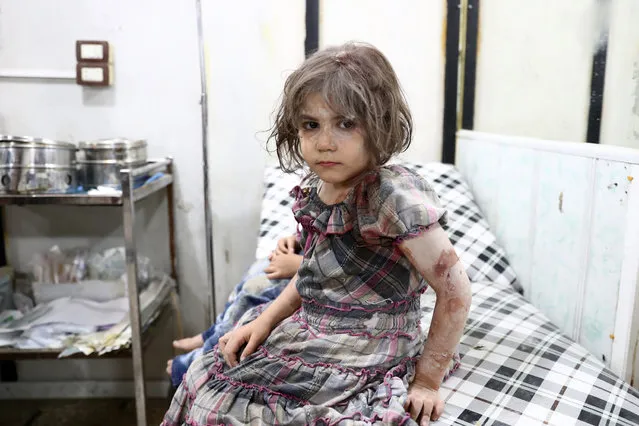 An injured Syrian child poses as she awaits treatment at a makeshift hospital following a reported air stike on the rebel-held town of Douma, east of the capital Damascus, on August 23, 2016. (Photo by Abd Doumany/AFP Photo)