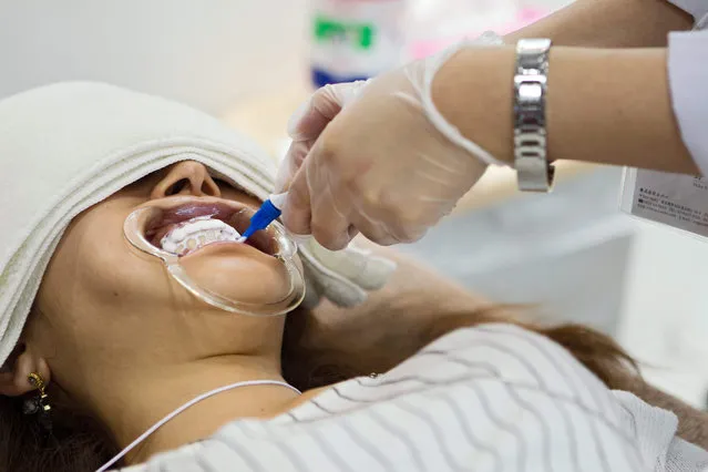 A visitor tries a teeth whitening procedure at the White Balance booth during Beautyworld Japan in Tokyo, Japan, 18 May 2015. Beauty world Japan is the largest trade show for the beauty and spa market in Japan showcasing 538 exhibitors from 14 different countries and regions. (Photo by Christopher Jue/EPA)