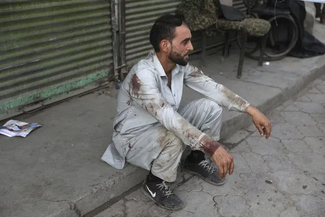 A blood-stained man rests after he helped people who were injured in a deadly bomb explosion in Kabul, Afghanistan, Tuesday, July 13, 2021. (Photo by Rahmat Gul/AP Photo)