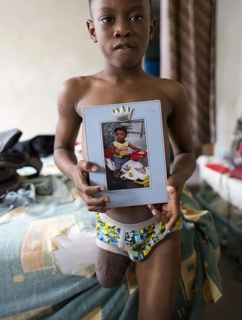 In this January 8, 2017 photo, Judeley Hans Debel stands on his one leg, holding a portrait of himself when he was 1-year-old, at his home in Petion-Ville, Haiti. When Judeley was 2 ½, he was one of thousands of people to undergo amputations after the powerful earthquake that devastated Haiti's capital seven years ago. (Photo by Dieu Nalio Chery/AP Photo)