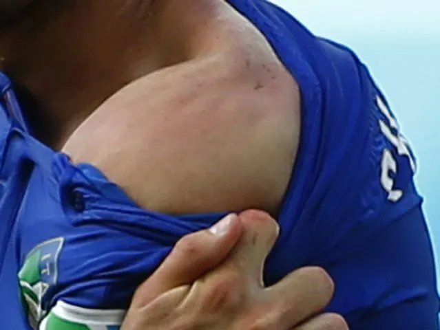 Italy's Giorgio Chiellini shows teeth marks on his shoulder where he was bitten by Uruguay's Luis Suarez, during their 2014 World Cup match at the Dunas arena in Natal in this June 24, 2014 file photo. I was covering Italy v. Uruguay and it felt almost just like any other match.  But in the second half, there was some strange contact between Italy's Giorgio Chiellini and Uruguay's Luis Suarez. (Photo and caption by Tony Gentile/Reuters)