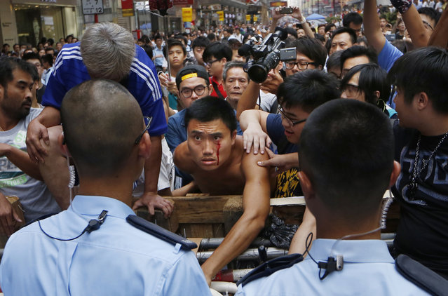 A protester bleeds from his face as he tries to stop a group of taxi drivers from trying to remove the barricades which are blocking off main roads, near a line of riot police at an occupied area, in the Mong Kok district of Hong Kong, Wednesday, October 22, 2014. Hong Kong student leaders and government officials talked but agreed on little Tuesday as the city's Beijing-backed leader reaffirmed his unwillingness to compromise on the key demand of activists camped in the streets now for a fourth week. (Photo by Kin Cheung/AP Photo)