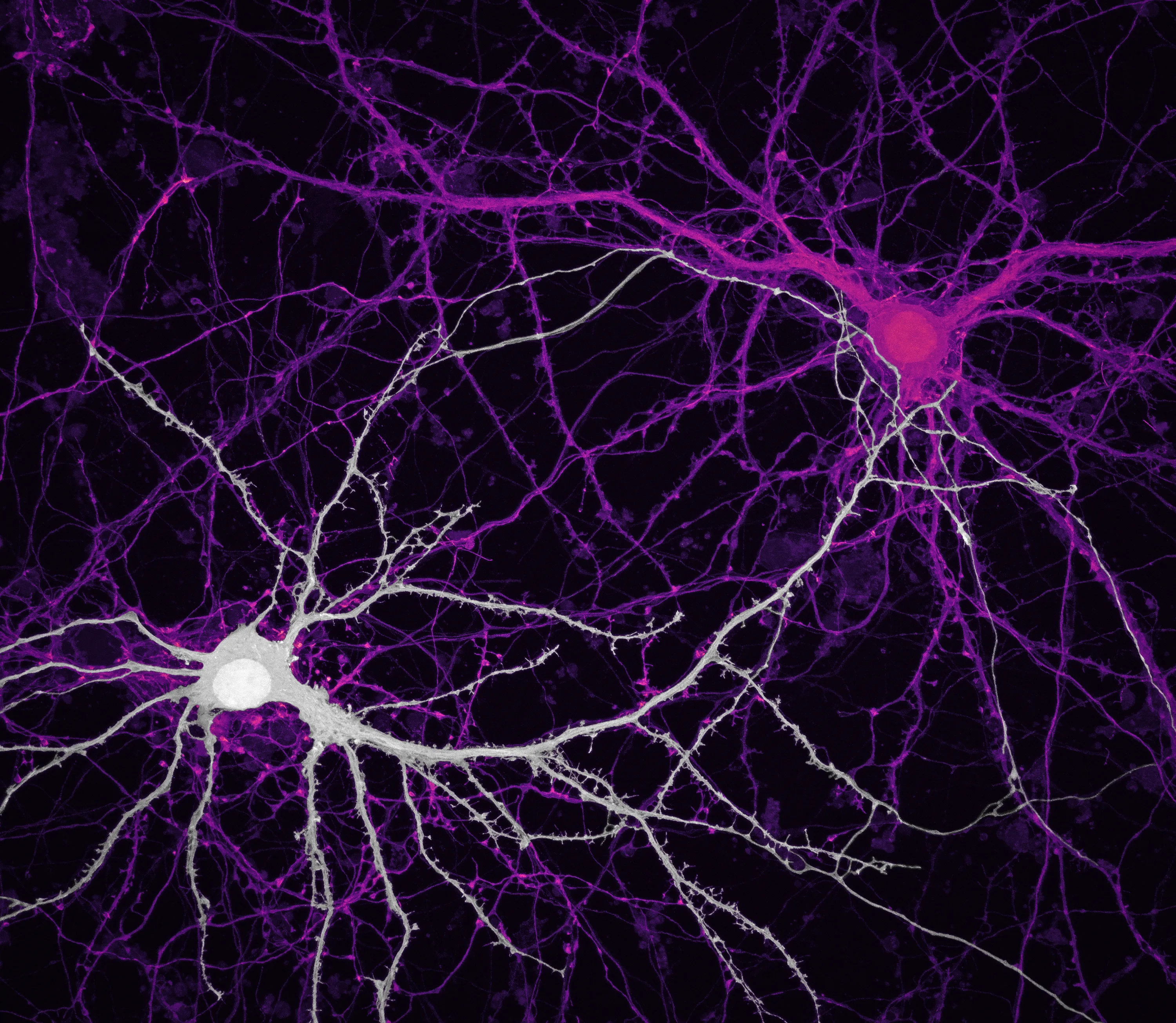 Восстановление клеток мозга. Нейрон Пуанкаре микрофотография. Нервные клетки микрофотография. Клетки мозга Нейроны. Клетки мозга под микроскопом.