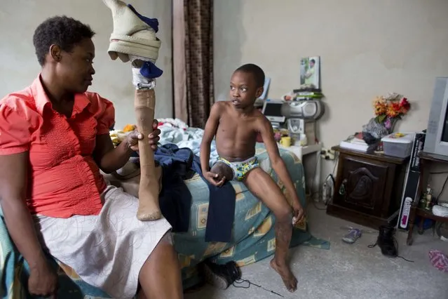 In this January 10, 2017 photo, Judeley Hans Debel chats after school with his mother Nerlande Jean Philippe who holds his prosthetic leg, at their home in Petion-Ville, Haiti. The single, unemployed mother struggles to support him and has to do her best maintaining his battered prosthetic leg as he grows because she can't afford a new one. (Photo by Dieu Nalio Chery/AP Photo)