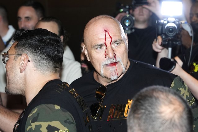John Fury, father of boxer Tyson Fury, with blood on his face during a media day in Riyagh on Monday, May 13, 2024 after headbutting a member of Oleksandr Usyk's camp. The IBF, WBA, WBC and WBO heavyweight title fight between Tyson Fury v Oleksandr Usyk will take place on Saturday 18th May. (Photo by Nick Potts/PA Images via Getty Images)