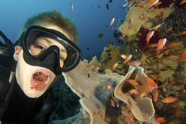 These unique photos capture the moment a boy has his teeth picked clean by amazing underwater shrimp. These fascinating creatures spend their lives diving inside the mouths of fish to remove the parasites that lurk there. (Photo by Tim Laman/Caters News)