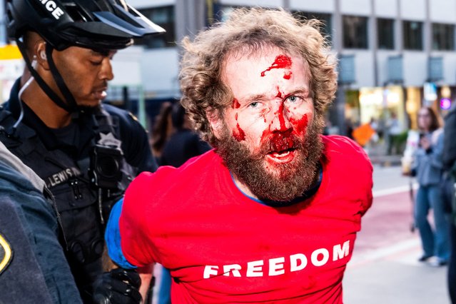 A bloodied man who was distributing “Freedom” shirts is detained following a scuffle with a protester outside a Turning Point USA event at the University of California, Berkeley on Monday, November 10, 2025, in Berkeley, Calif. (Phoot by Noah Berger/AP Photo)