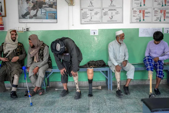 In this photograph taken on October 11, 2021, Mullah Yacoub (3L), a Taliban member who claims to have lost his leg in an US force strike, tries on his new prosthetic leg at International Committee of Red Cross Rehabilitation Centre in Kabul. Just months ago they were fighting each other as mortal enemies, but today they are amputees dealing with their new disability, together. At this Red Cross-run rehabilitation centre in Kabul, former Afghan government soldiers and Taliban fighters adjust their new prostheses, living side by side. (Photo by Bulent Kilic/AFP Photo)