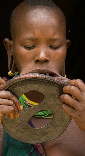 Woman With The World's Biggest Lip Disc