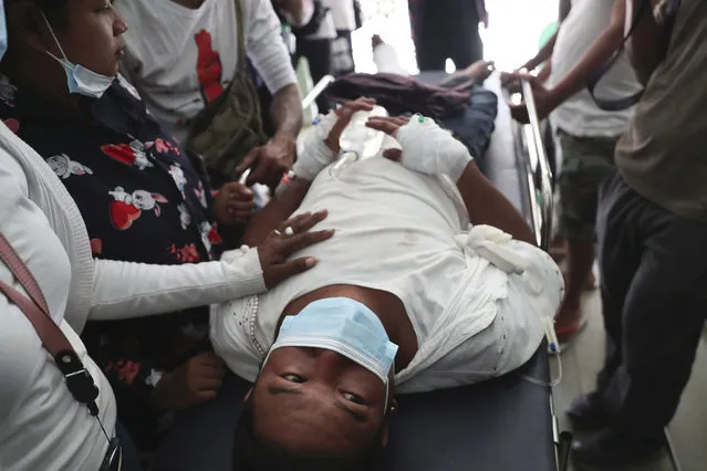 An injured protester is tended to during a demonstration against the military coup in Mandalay, Myanmar, Friday, February 26, 2021. Security forces in Myanmar's largest city on Friday fired warning shots and beat truncheons against their shields while moving to disperse more than 1,000 anti-coup protesters. (Photo by AP Photo/Stringer)