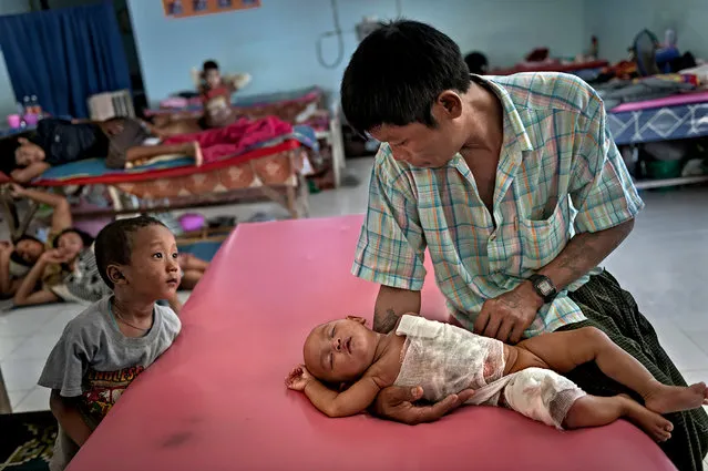 At the Mae Tao Clinic this 5-month old child receives free medical care for her burns. The child pulled a pot of hot water on herself as she was being watched by her 11-year old sister while her parents farmed. Here, her father, Zaw Win, and another child anxiously hope for her recovery. Mae Sot, Thailand. (Photo by Renée C. Byer/Living on a Dollar a Day)