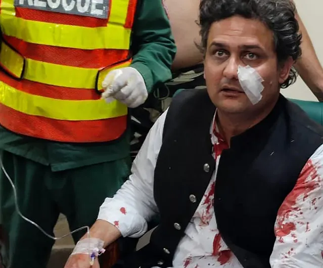 In this photo released by former Pakistani Prime Minister Imran Khan's party, Pakistan Tehreek-e-Insaf, Faisal Javed, a senator and close aid of Khan, who was injured in a shooting incident waits to receive first aid, in in Wazirabad, Pakistan, Thursday, November 3, 2022. A gunman opened fire at a campaign truck carrying Khan on Thursday, wounding him slightly and also some of his supporters, a senior leader from his party and police said. (Photo by Pakistan Tehreek-e-Insaf via AP Photo)