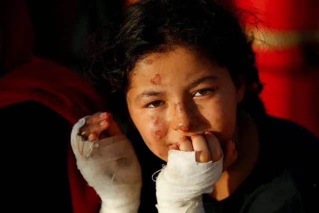 A Libyan girl, who suffered burns in a fire on a boat of migrants, sits on the German NGO migrant rescue ship Sea-Watch 3 as it reaches a rendezvous point with the Italian Coast Guard to medically evacuate injured and sick migrants, off the coast of the Italian island of Lampedusa in the western Mediterranean Sea, July 30, 2021. (Photo by Darrin Zammit Lupi/Reuters)