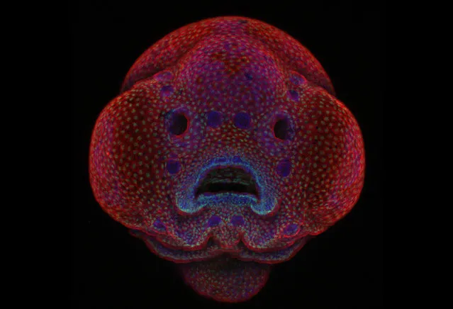 Each year Nikon Small World recognizes the excellence of photography taken under the microscope.  The contest showcases the beauty and complexity of life. Anyone interested in microscopy and photography can enter the contest and in its 42nd year, Nikon Small World received 2,000 entries from 70 countries. Here: 1st Place: Four-day-old zebrafish embryo. (Photo by Dr. Oscar Ruiz/Nikon's Small World 2016)