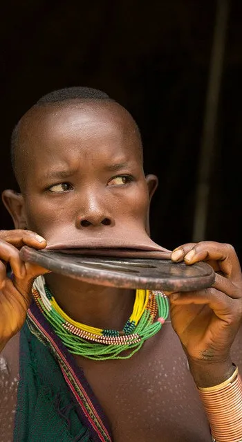 Woman With The World's Biggest Lip Disc