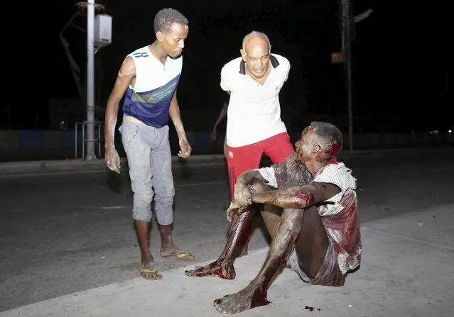 A Somali man injured in a night car bomb attack near a hotel in Hamarweyne district sits along a sidewalk near the scene in capital Mogadishu, Somalia February 26, 2016. (Photo by Feisal Omar/Reuters)