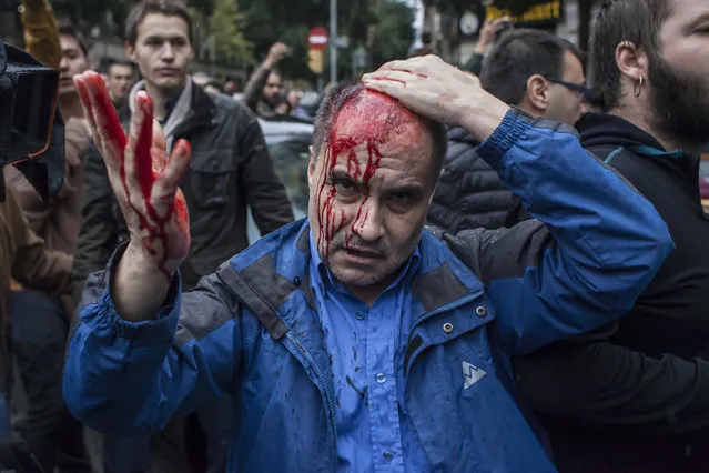 A man got hurt after being hit by a plastic bullet. People clash with the Spanish police “Policia Nacional” after they closed down a polling station.Today the referendum was held to vote for the independence of Catalunya region. (Photo by Andrea Baldo/LightRocket via Getty Images)