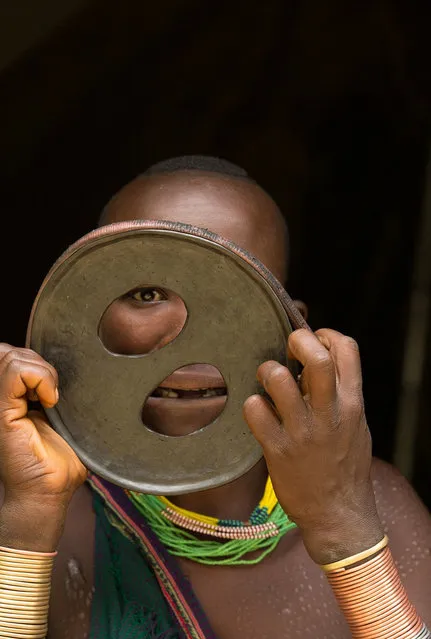 Woman With The World's Biggest Lip Disc