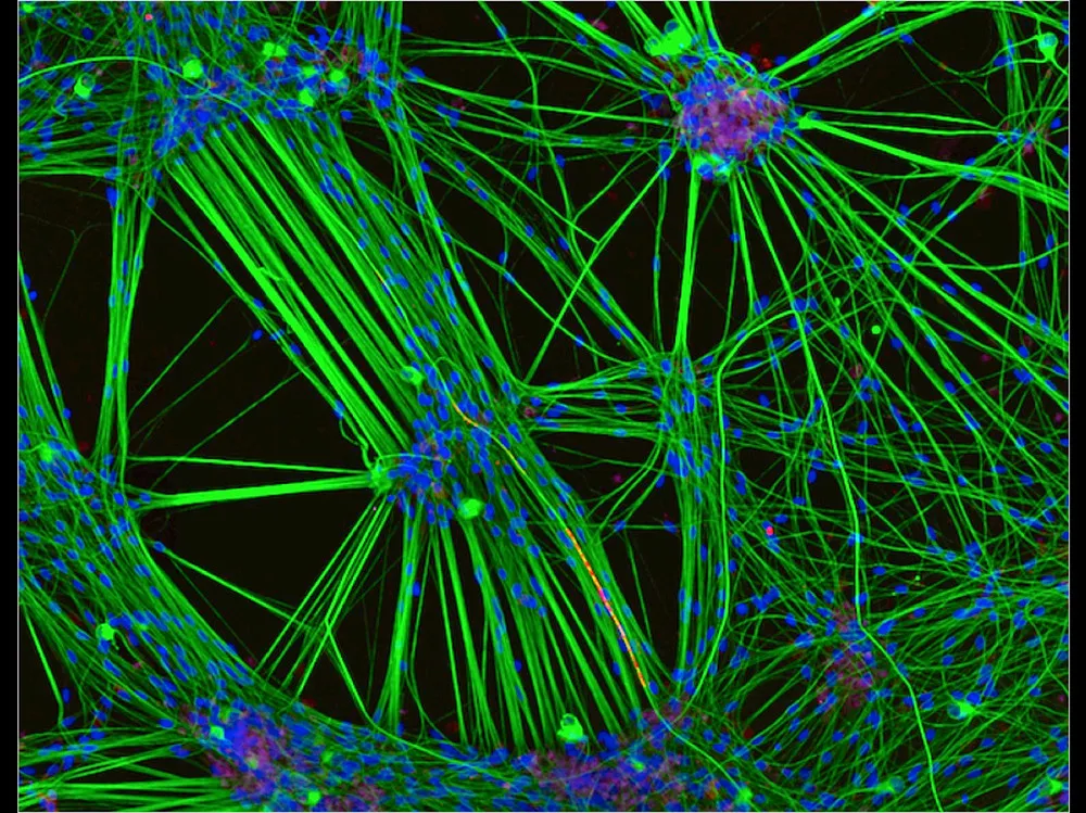 Nikon Small World 2016