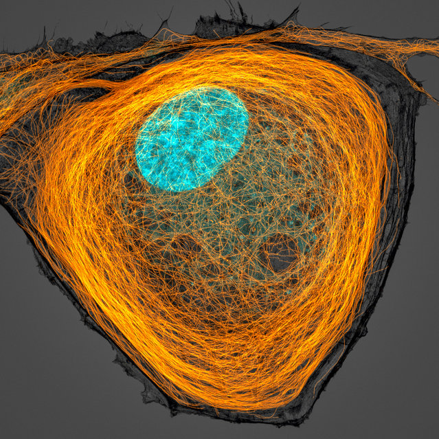 7th Place. Microtubules (orange) inside a cell. Nucleus is shown in cyan. Confocal 63X (objective lens magnification). (Photo by Jason Kirk/Nikon Small World Photomicrography 2020)