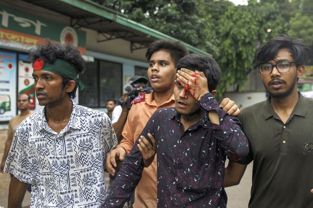 A student injured during a clash between anti-quota protesters and Bangladesh Chhatra League, the student wing of the ruling party Bangladesh Awami League in the University of Dhaka campus. At Least five demonstrators were Killed in Bangladesh on July 16 during violent clashes between rival student groups over quotas for coveted government jobs, police said, a day after more than 400 others were injured. (Photo by K M Asad/LightRocket via Getty Images)