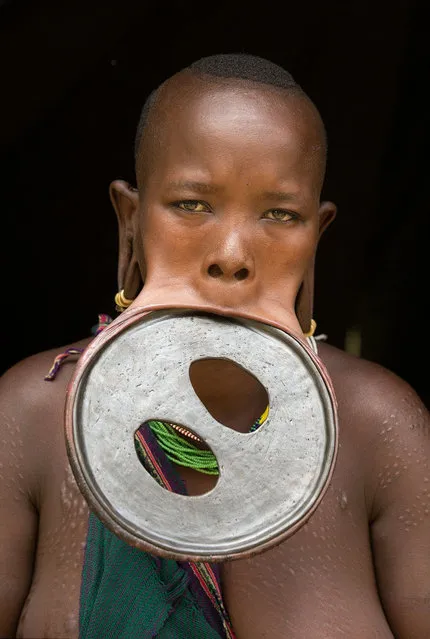 Woman With The World's Biggest Lip Disc