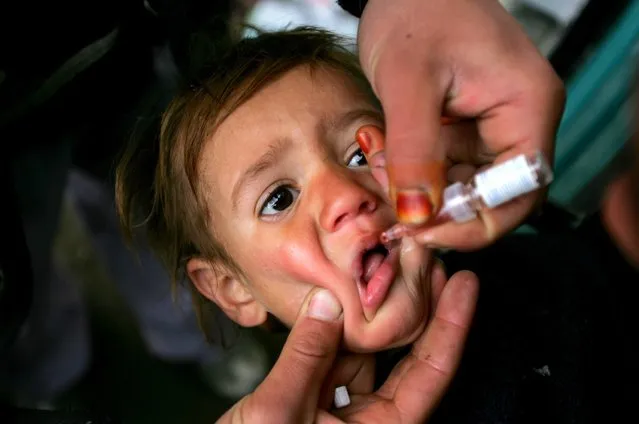An Afghan boy receives polio vaccination drops during an anti-polio campaign in Kabul, Afghanistan on March 5, 2006. (Photo by Reuters/Stringer)