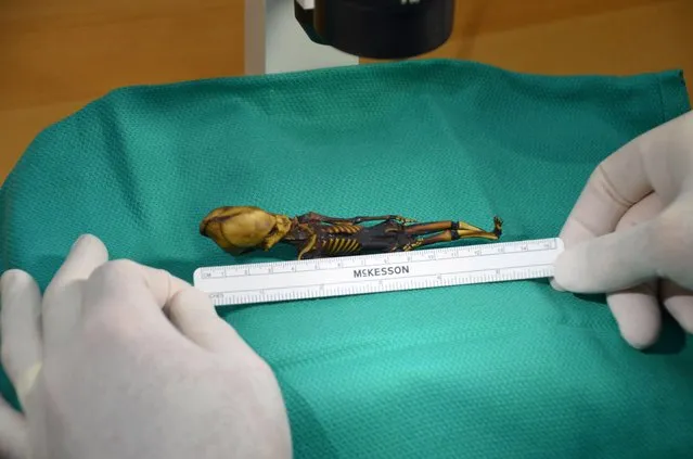 This undated image courtesy of Dr. Emery Smith show a tiny, mummified skeleton discovery in 2003 in Chile' s Atacama Desert, tucked into a leather pouch behind a church The notion that it was an extra- terrestrial was long ago debunked, but researchers said on March 22, 2018, they have gleaned new insights from a full genetic analysis which showed the skeleton, nicknamed “Ata”, belonged to an infant girl with a handful of rare gene mutations linked to dwarfism, deformities and apparent premature aging. (Photo by AFP Photo/HO)