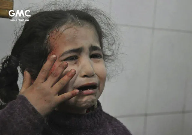 This photo released on Wednesday February 21, 2018 provided by the Syrian anti-government activist group Ghouta Media Center, which has been authenticated based on its contents and other AP reporting, shows a Syrian young girl who was wounded during airstrikes and shelling by Syrian government forces, cries at a makeshift hospital, in Ghouta, suburb of Damascus, Syria. New airstrikes and shelling on the besieged, rebel-held suburbs of the Syrian capital killed at least 10 people on Wednesday, a rescue organization and a monitoring group said. (Photo by Ghouta Media Center via AP Photo)
