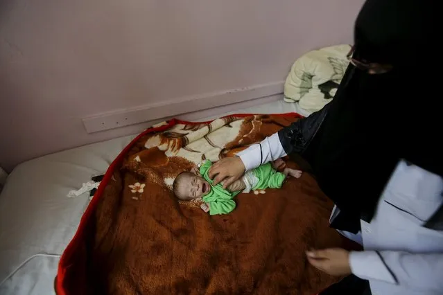 A nurse  checks a malnourished child at a hospital in Yemen's capital Sanaa July 28, 2015. The war in Yemen has killed more than 3,500 people. U.N. children's agency UNICEF says the death toll includes 365 children. (Photo by Khaled Abdullah/Reuters)