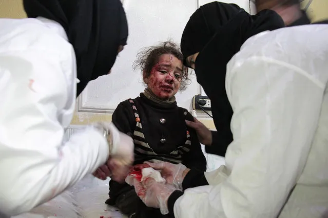 A Syrian girl who was injured in bombardment cries as she receives treatment at a make-shift hospital in the besieged rebel-held town of Douma, on the outskirts of the capital Damascus on January 6, 2018. The deadliest of Syrian regime and Russian air strikes on the Eastern Ghouta region hit the Hammuriyeh district, leaving 12 civilians dead including two children, the Syrian Observatory for Human Rights said. (Photo by Hamza Al-Ajweh/AFP Photo)