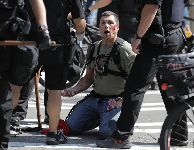 A man who was protesting with Patriot Prayer and other groups supporting gun rights is treated for an injury during a rally and counter-protest, Saturday, August 18, 2018, near City Hall in Seattle. (Photo by Ted S. Warren/AP Photo)