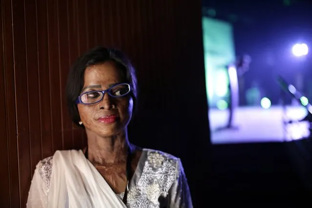 Hasina, one of the acid violence survivors poses for a photograph during the national conference organised by Acid Survivors Foundation in Dhaka, Bangladesh, 05 March 2016. More than 300 survivors of acid attacks from different parts of the country attended the national conference. The total number of survivors rose to 3661 from 3303 incidents since 1999 till 2015, according to the Acid Survivors Foundation. (Photo by Abir Abdullah/EPA)