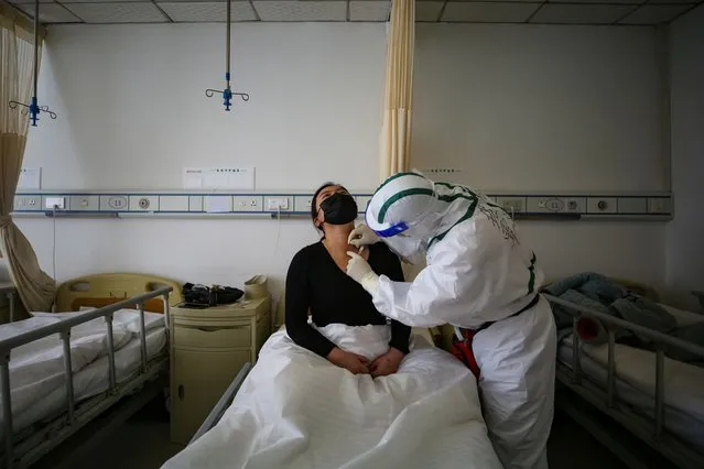 A patient (L) infected by the COVID-19 coronavirus receives acupuncture treatment at Red Cross Hospital in Wuhan in China's central Hubei province on March 11, 2020. China reported an increase in imported coronavirus cases on March 11, fuelling concerns that infections from overseas could undermine progress in halting the spread of the virus. (Photo by AFP Photo/China Stringer Network)