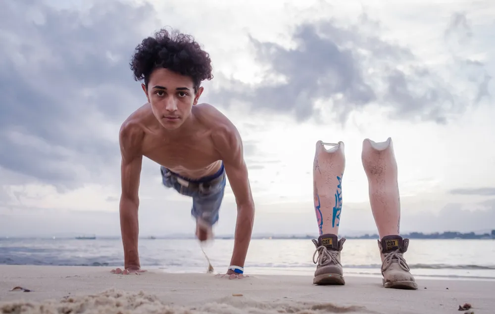 The Amputee Breakdancer from Tunisia