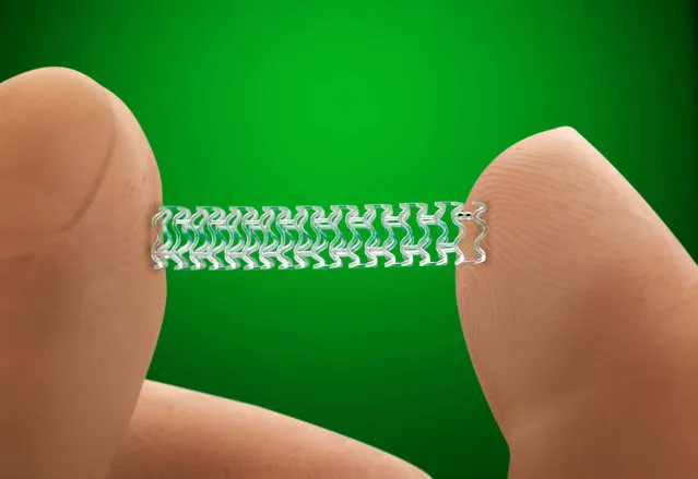 This undated image provided by Abbott shows their experimental heart stent “Absorb”. The FDA holds a meeting Tuesday, March 15, 2016, to review Abbott Laboratories’ first-of-a-kind heart stent that dissolves into the body after helping to clear fat-clogged arteries. Stents are tiny, mesh-wire tubes that prop open arteries after they have been cleared of fatty plaque. (Photo by Weinberg-Clark Photography/Abbott via AP Photo)
